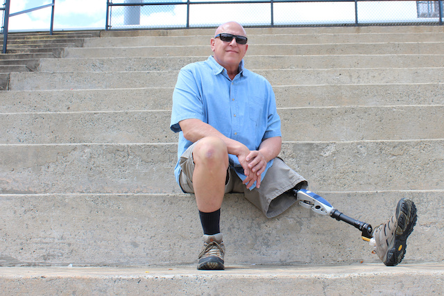 Seated man with prosthetic leg outstretched